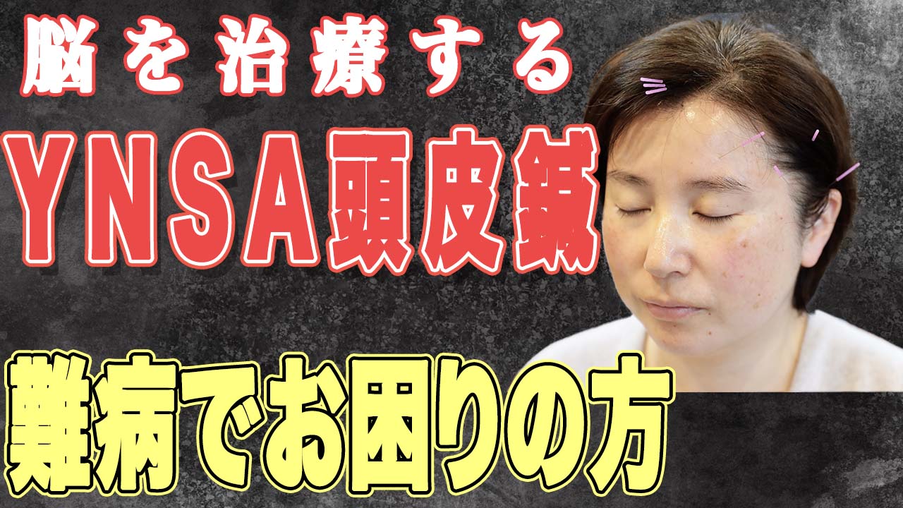 YNSA山元式新頭鍼療法について紹介するYouTube動画