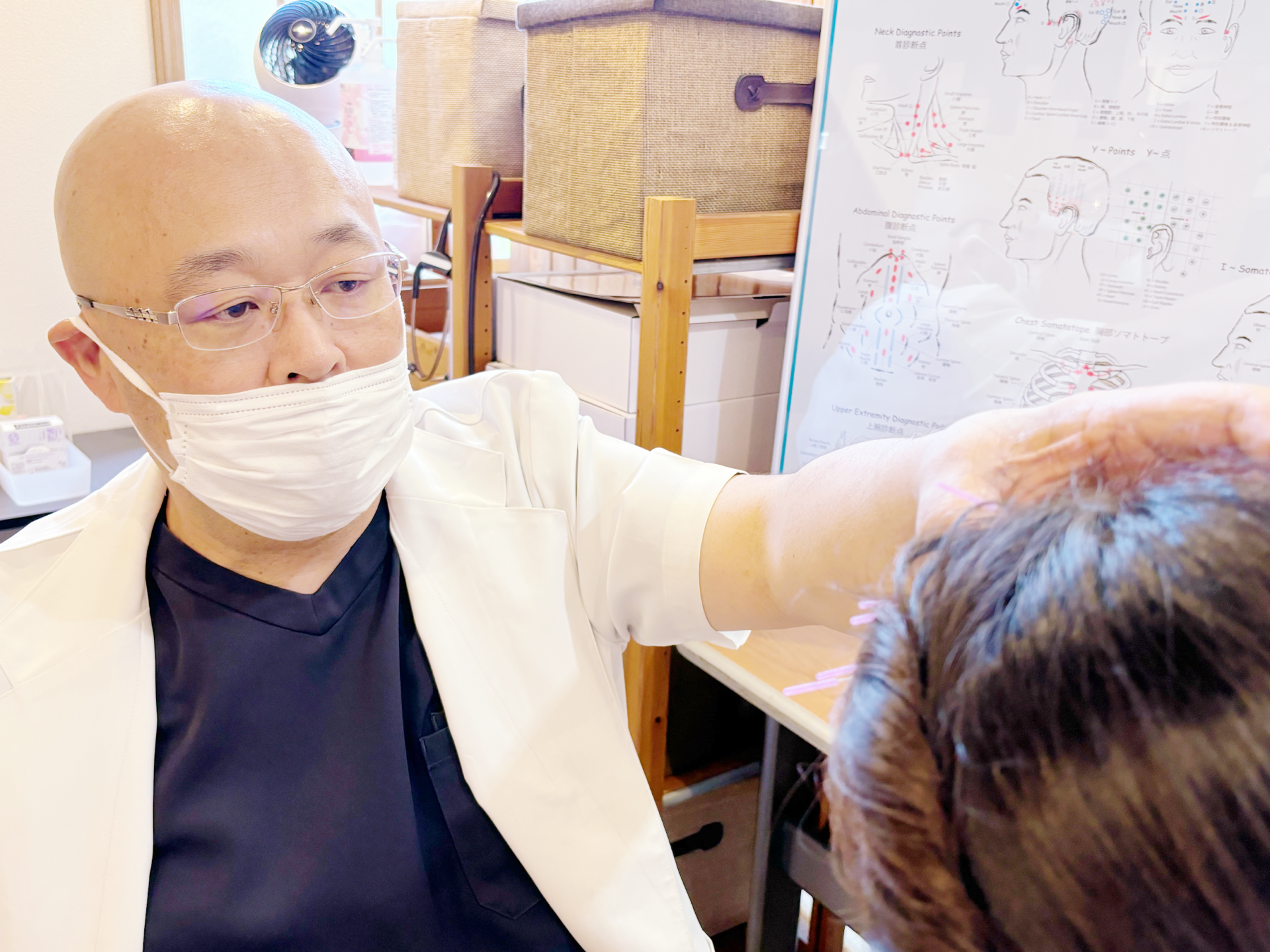 めまいやふらつきに対してYNSA山元式新頭鍼療法を行う様子