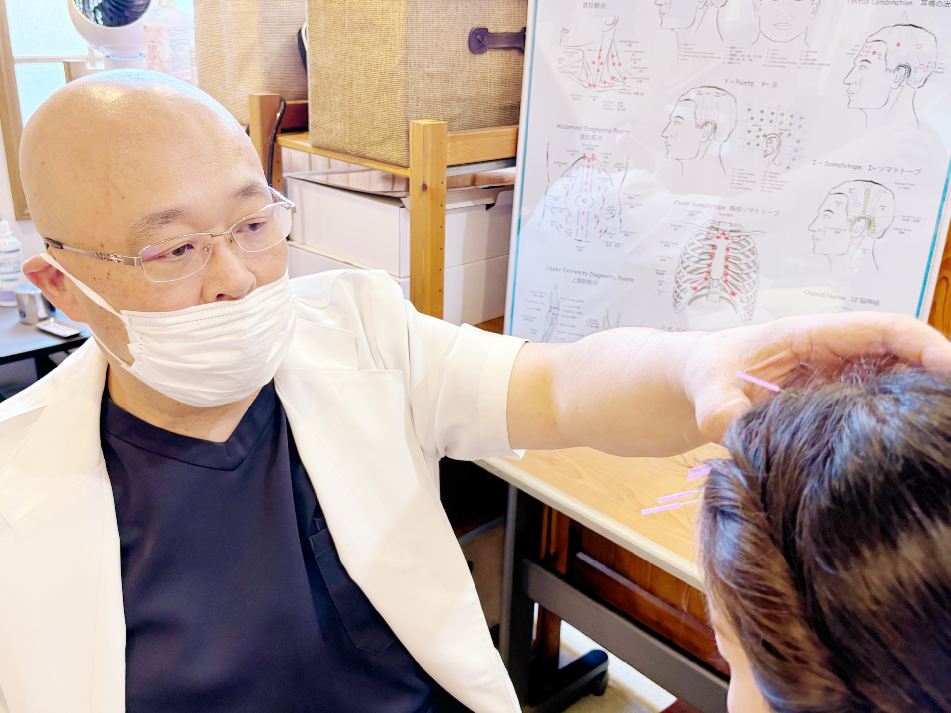 YNSA山元式新頭鍼療法による頭皮への鍼施術
